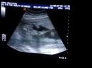 ultrasound of my baby ultrasound of my baby