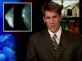 World Health News Today: Body Mass Index