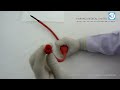 Product Video: Enema Syringe Higginson, in Red Colour Rubber with Rectal Nozzle & Valve. More Info: narang.com Buy Online surgicalshop.com Email Bulk Enquiries youtube@narang.com Category: Surgical/Medical Rubber Goods, Enema Products Manufacturer & Supplier: Narang Medical Limited, India. Brand Name: NET Description: Enema Syringe Higginson, in Red Colour Rubber with Rectal Nozzle & Valve. Item Code: RU011