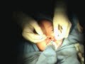 Cirug�a Maxilofacial