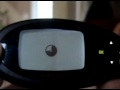 Diabetes Dexcom Screen Setup for Continous Glucose Sensor