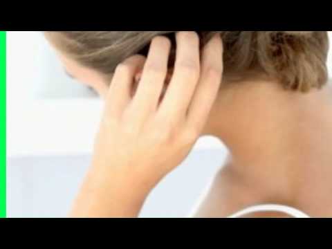 how to relieve urticaria