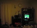 Loud snoring Loud snoring