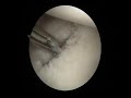 suergery