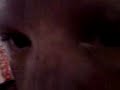 My face (ouch)