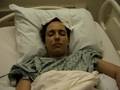 SURGERY #3 at CEDARS SINAI For CHIARI MALFORMATION