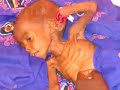 DARFUR: \"No More Tears\" DARFUR: \"No More Tears\"
