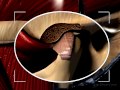 Click here to watch this video TMJ/TMD.wmv