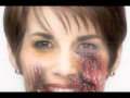 kyle dyer dog bite photos - YouTube