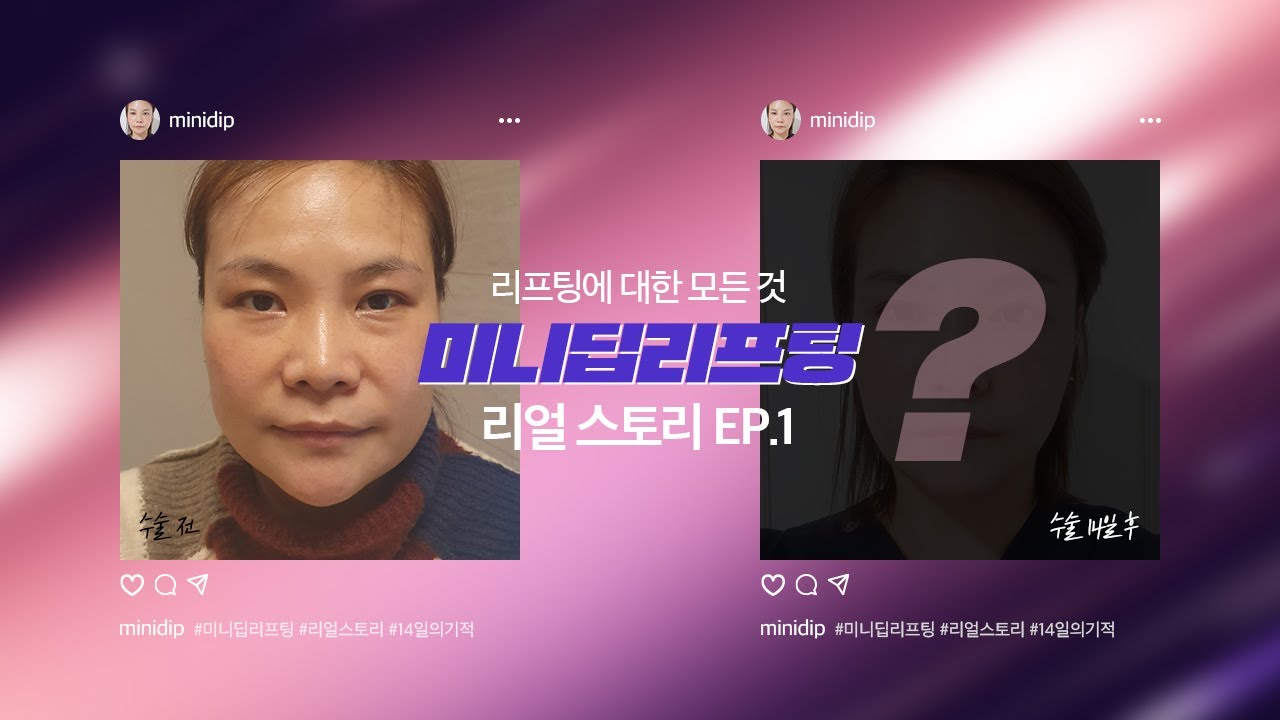 리팅성형외과