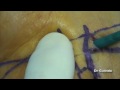 sd tunel carpiano  dr e galindo martens   dr  g  andujar