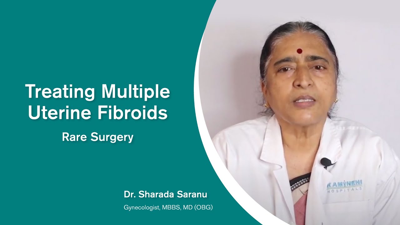 Treating Multiple Uterine Fibroids | RARE SURGERY | Dr. Sharada Saranu