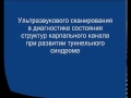 Нажмите для просмотра : Карпальный синдром