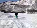 x no foot