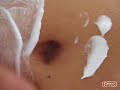 Belly lotion Belly lotion