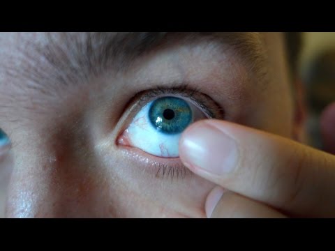 EYE EATING PARASITE!? (DAY - 202)