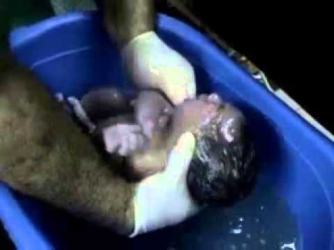 Video Parto Vaginal Normal con episiotomía y sutura Childbirth + episiotomy