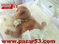 SNAKE BABY- ADANA YILAN BEBEK