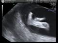 Baby McDee 2