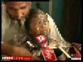 Muslim Uncle Burns 11 yr. old Niece For Wearing Lipstick
