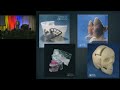 2011 Frontiers of Engineering: Additive Manufacturing is Changing Surgery
