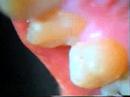 Dientes