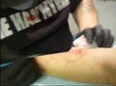 Chris does scarification