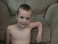 Autism MB12 shots (Before + After footage)