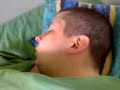 Snoring