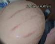 barriga mellizos 33 semanas