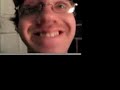 Thumbnail #1