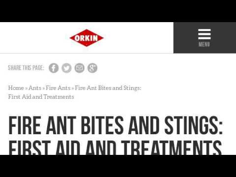 how to treat fire ant bites