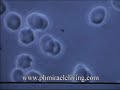 live blood analysis