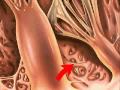 The Heart Mitral Valve
