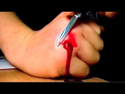 how to drain pus from a wound