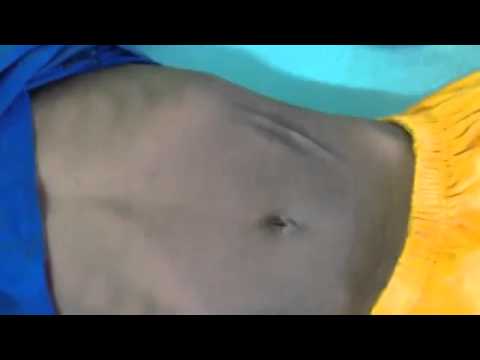 how to treat dehydration in infants