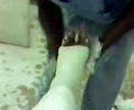 Ahhh a cast! right before spring break!