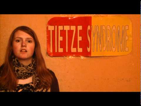 how to treat tietze syndrome