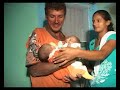 REPORTAGEM DARLENE-GÊMEOS SIAMESES