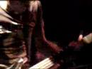 Head Wound City : LIVE in San Diego  PART 2