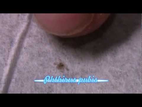 how to get rid pubic lice