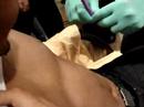 Me getting my nippy done ! Me getting my nippy done !