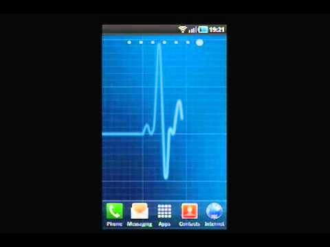 Heartbeat Healthy ECG | SlideME Heartbeat Healthy ECG | SlideME