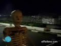 Broma del esqueleto
