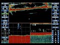 trawl sonar