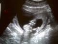 videos de Baby Girl Hughes 12/3/08 Sonogram #3