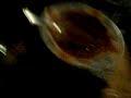 tony vs alfonzo real fight tony vs alfonzo real fight