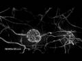 Nanobots replacing neurons