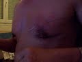 video enlevement aiguilles.MOV