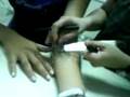 aula fototerapia - laser - bandagem